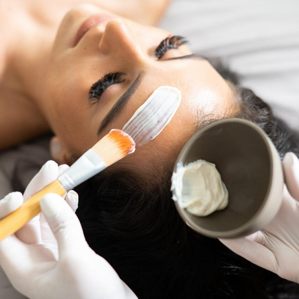 Chemical Peels vs. Facials